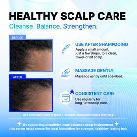 CELDYQUE application demo with roll-on on thinning-prone scalp