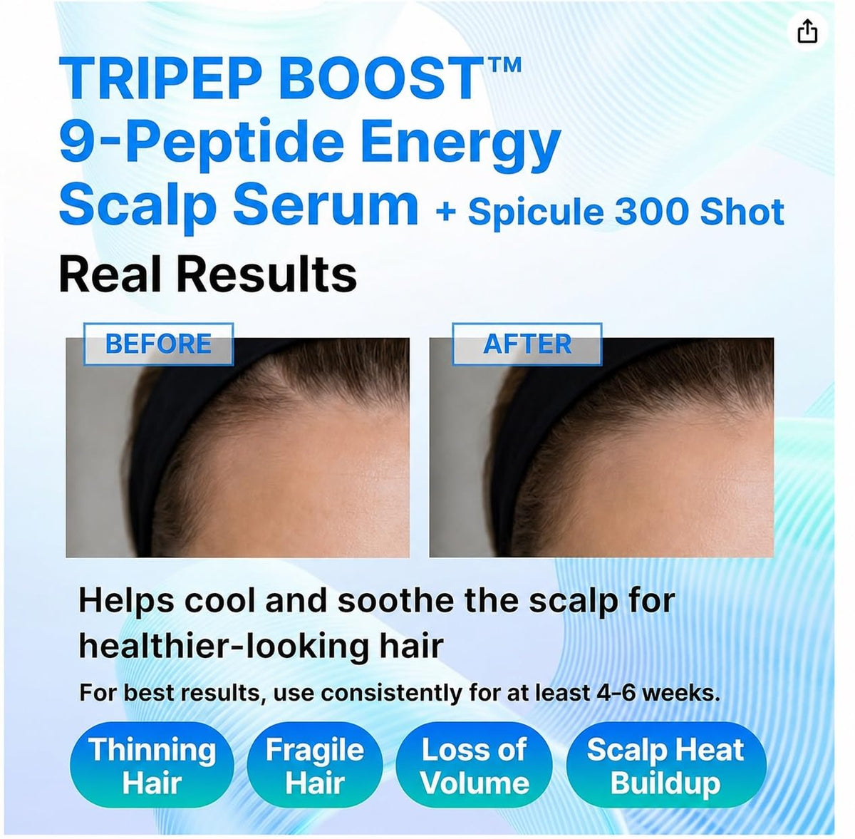 CELDYQUE spicule and peptide concept illustrating root contact