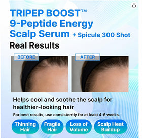 CELDYQUE spicule and peptide concept illustrating root contact