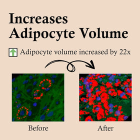 CELDYQUE Volufiline ingredient close-up illustrating plumping benefits and volume support