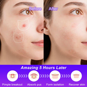 CELECARE patch applied on skin demonstrating discreet coverage benefit