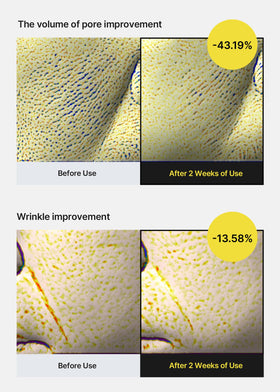 celimax ingredient graphic highlighting retinol and peptides, clarity on actives