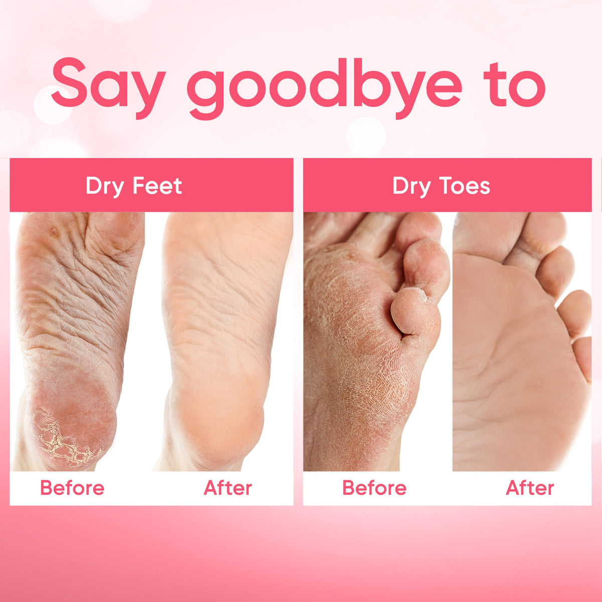 CÉLOR before and after feet photo showing reduced calluses and smoother heels