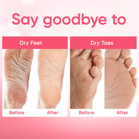 CÉLOR before and after feet photo showing reduced calluses and smoother heels