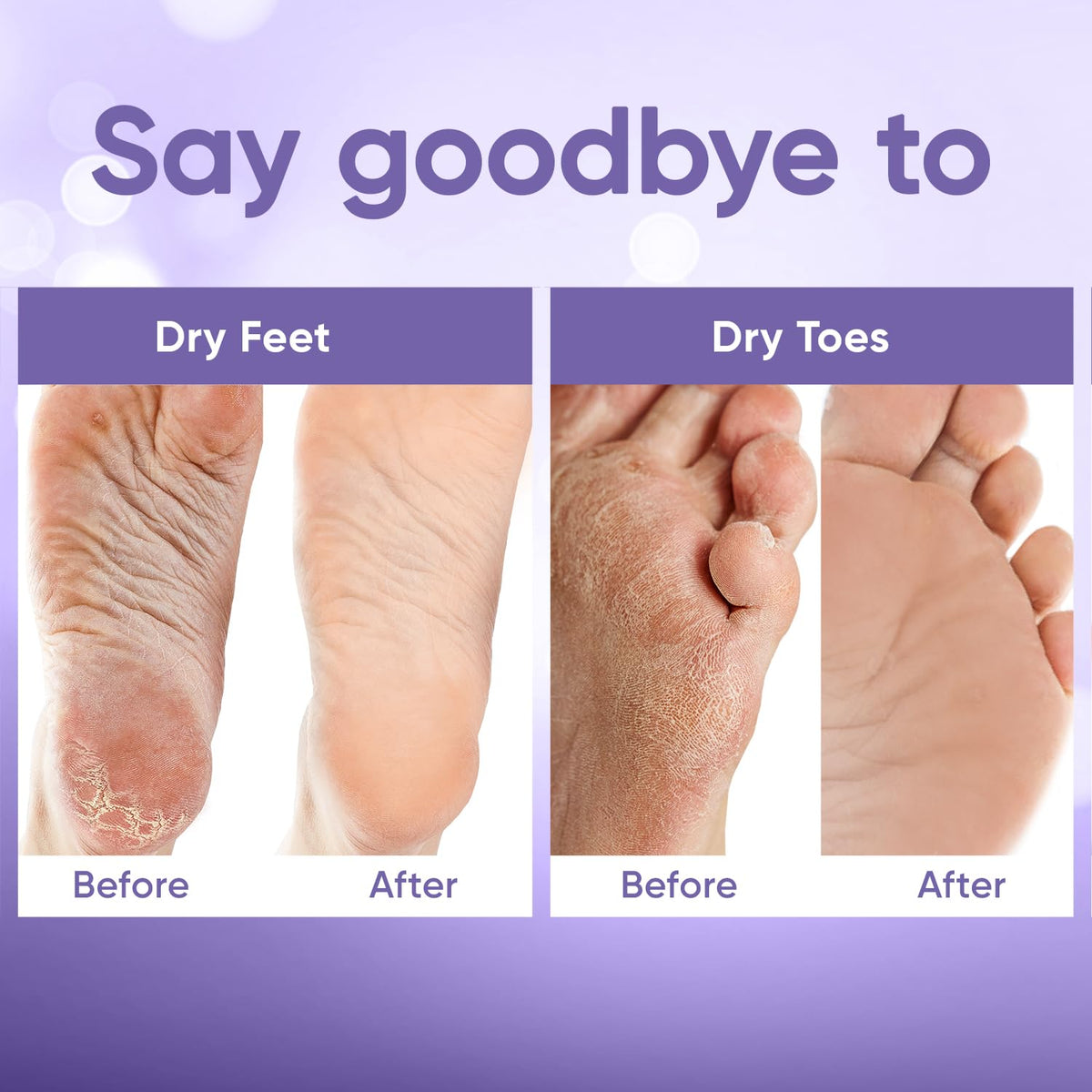 CÉLOR before and after feet comparison, illustrating smoother, softer skin result