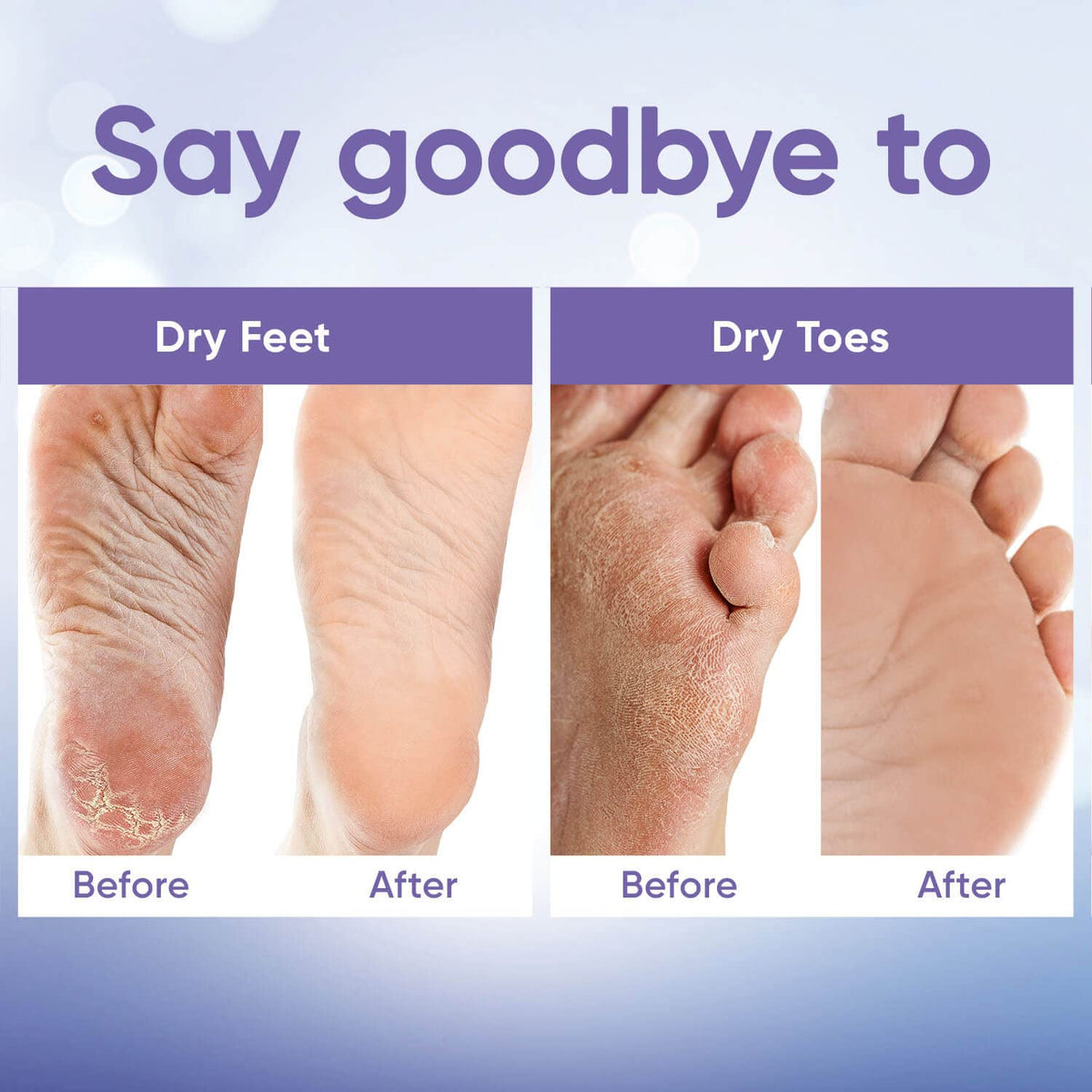 CÉLOR before and after feet comparison showing smoother results after peel