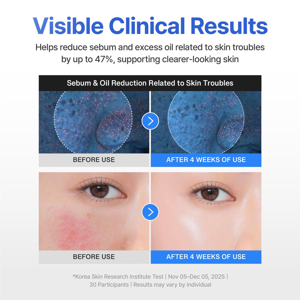 CENTELLIAN 24 application on cheek depicting soothing finish and reduced redness