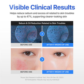 CENTELLIAN 24 application on cheek depicting soothing finish and reduced redness