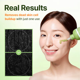 CENTELLIAN 24 charcoal capsules detail visually highlighting impurity absorption