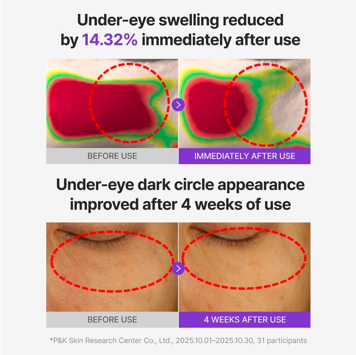 Centellian 24 patch applied under eye demonstrating cooling de-puffing effect
