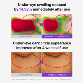 Centellian 24 patch applied under eye demonstrating cooling de-puffing effect