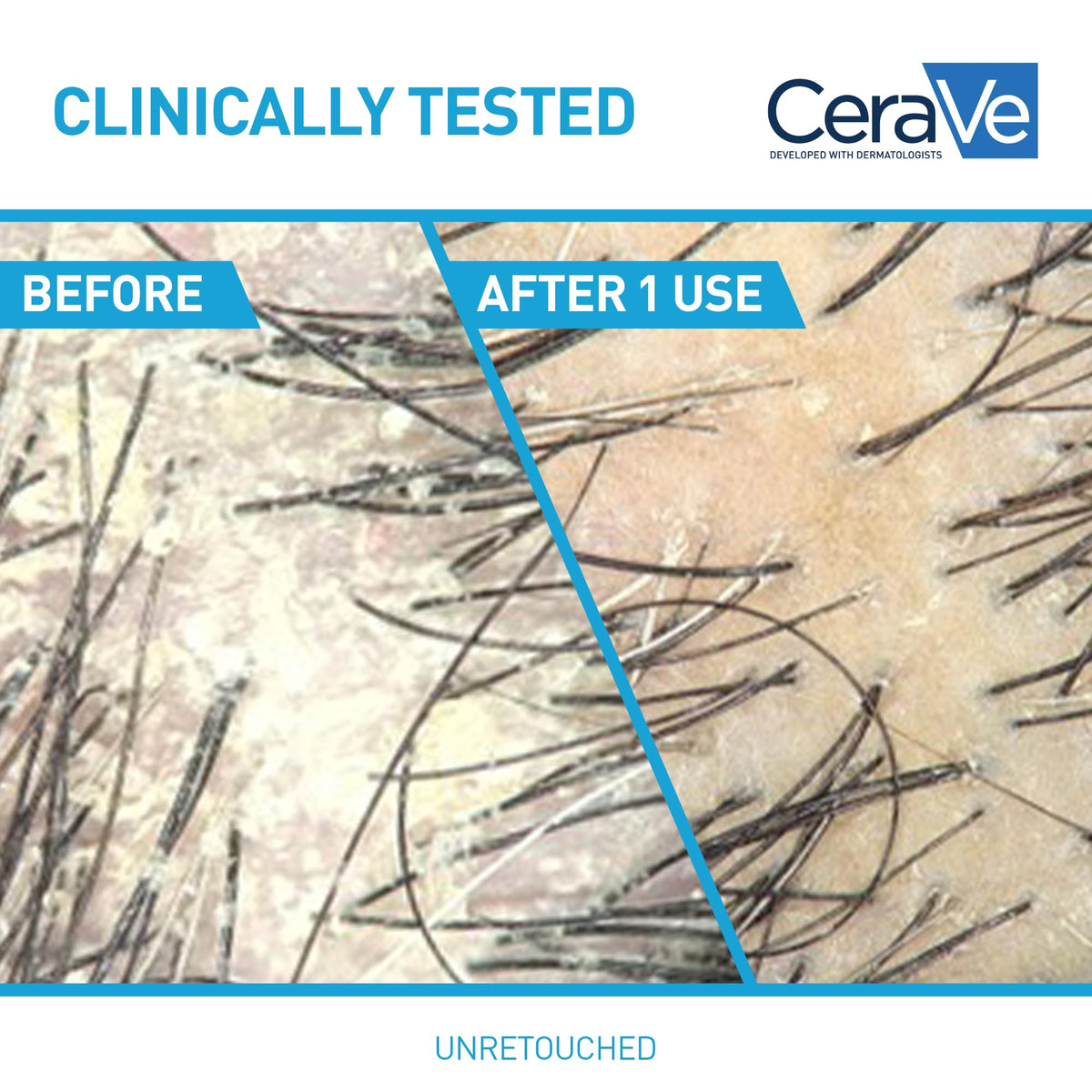 Foamy lather texture of CeraVe shampoo demonstrating gentle cleanse
