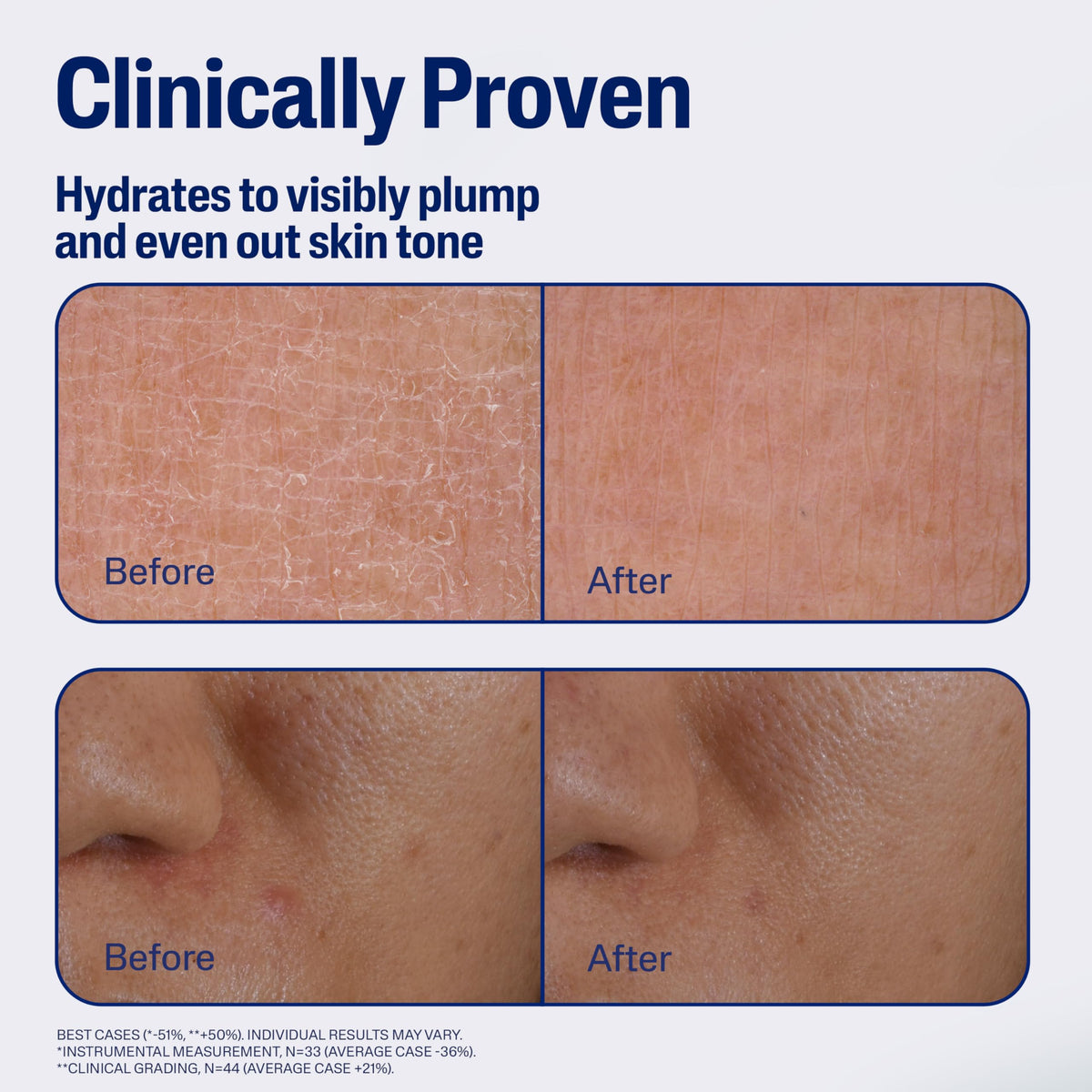 Cetaphil applied on hand during night routine demonstrating soothing effect