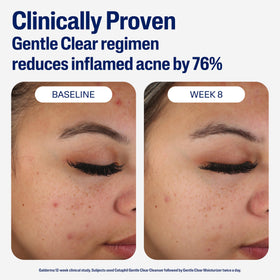 Cetaphil side-by-side texture comparison showing smoother skin finish