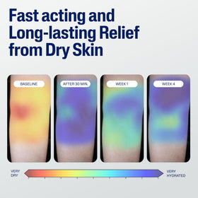 Using Cetaphil on elbow and knee to soften very dry rough patches