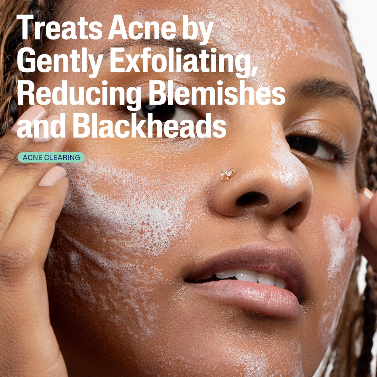Cetaphil gel texture close-up demonstrating lightweight exfoliating formula