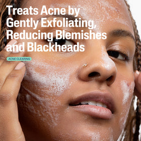Cetaphil gel texture close-up demonstrating lightweight exfoliating formula