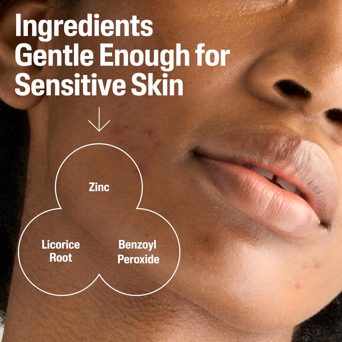 Cetaphil ingredients zinc and licorice root highlighting soothing action