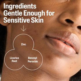 Cetaphil ingredients zinc and licorice root highlighting soothing action