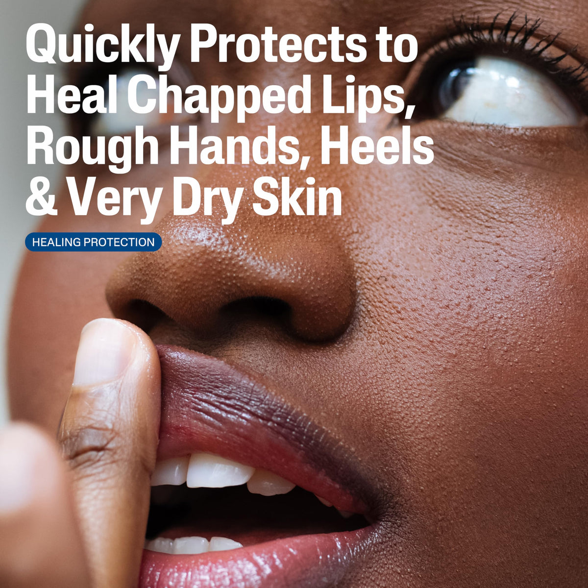 Close-up of shea butter in Cetaphil healing ointment illustrating moisturizing benefits
