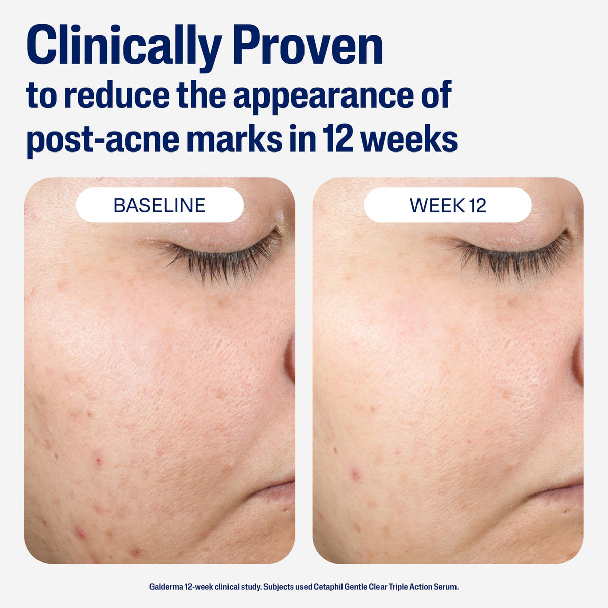 Cetaphil ingredient display with bakuchiol and zinc highlighting tone improvement