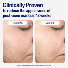 Cetaphil ingredient display with bakuchiol and zinc highlighting tone improvement