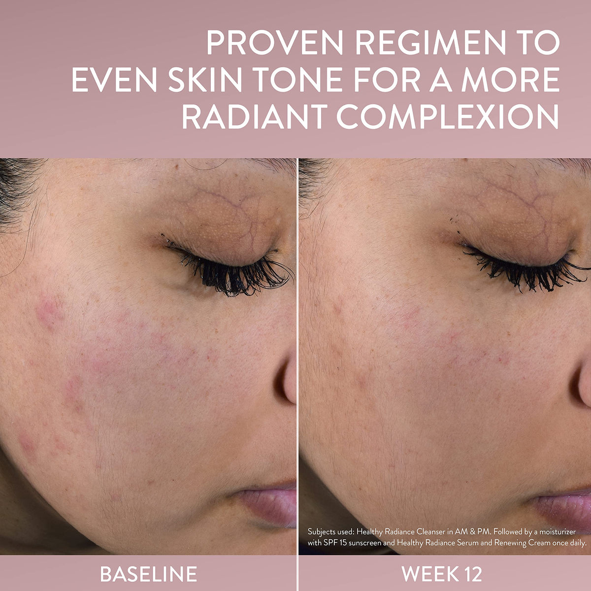Cetaphil niacinamide and Vitamin C visual emphasizing brightening