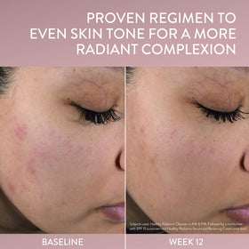 Cetaphil niacinamide and Vitamin C visual emphasizing brightening