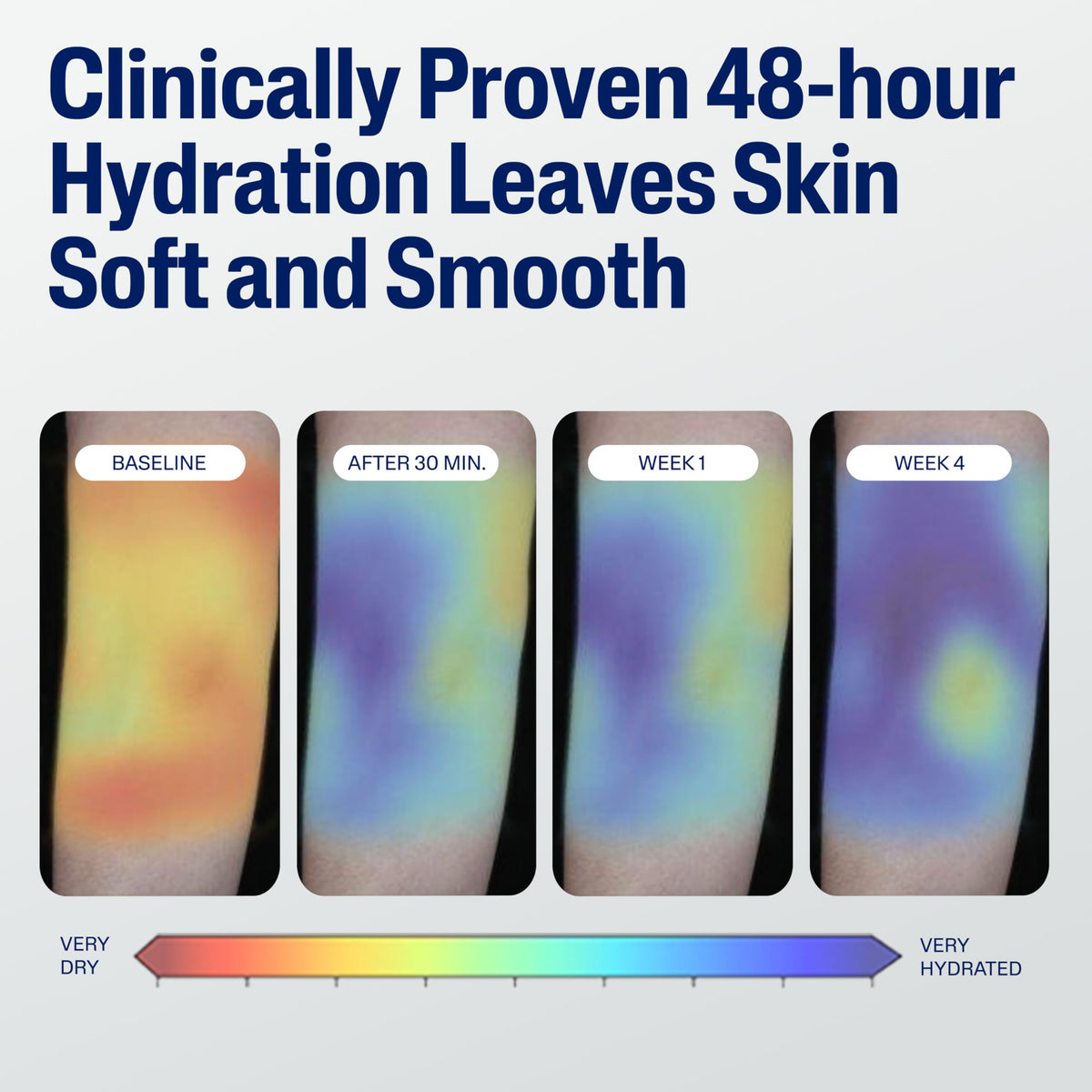 Hydrated knees and elbows with Cetaphil highlighting targeted moisture care