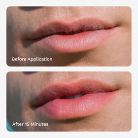 Chaddy applicator wand close-up illustrating precise, mess-free application
