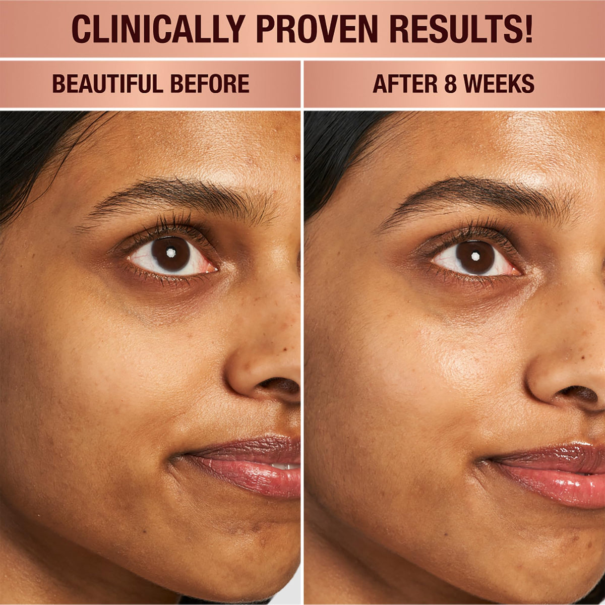 Charlotte Tilbury applying with finger to orbital bone, demonstrates gentle cooling benefit