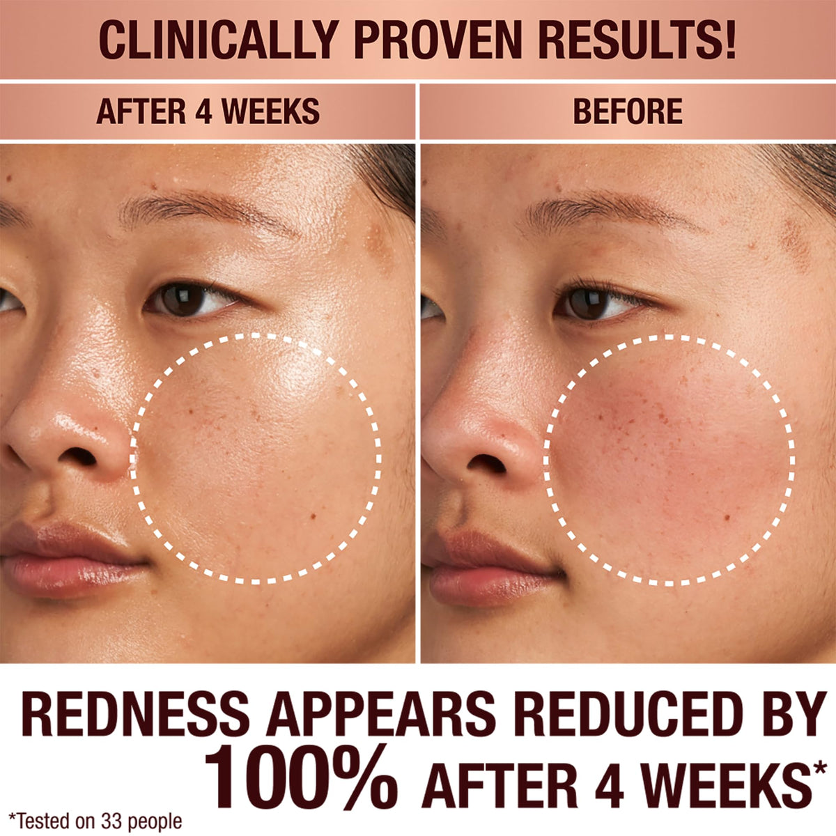 Charlotte Tilbury application image with cream being tapped into skin for glow