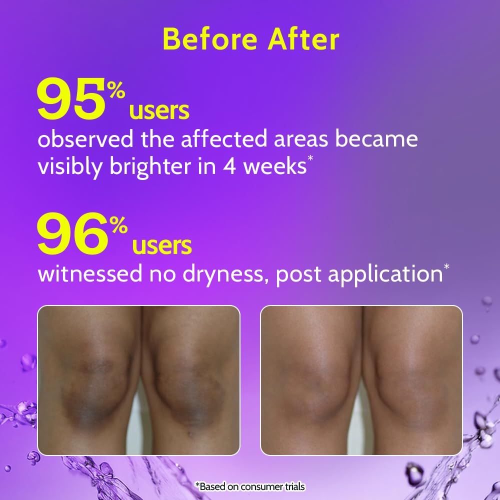 Chemist at Play applied to neck demonstrating reduced roughness and even tone