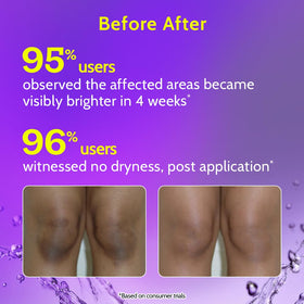 Chemist at Play applied to neck demonstrating reduced roughness and even tone