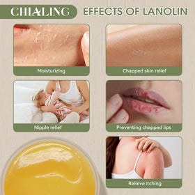 Chialing on hands and elbows showing barrier protection benefit