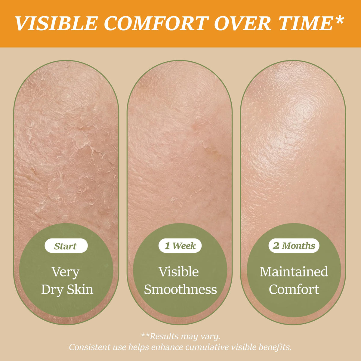 ChiroLife application on fingers showing easy warming and spreadability