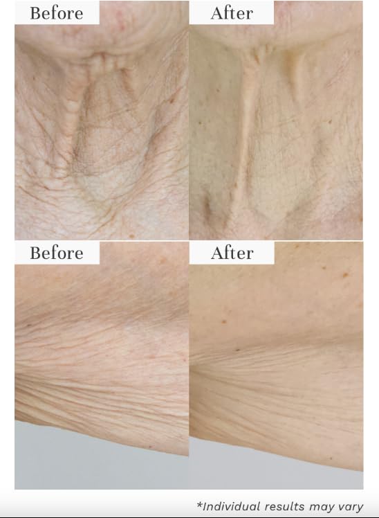 City Beauty jar open showing balm texture and smooth application