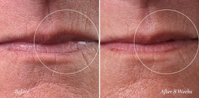 City Beauty application with spatula demonstrating precise, hygienic application