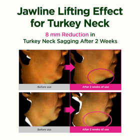 CKD Guaranteed gua sha along jawline showcasing contouring and lifting benefit
