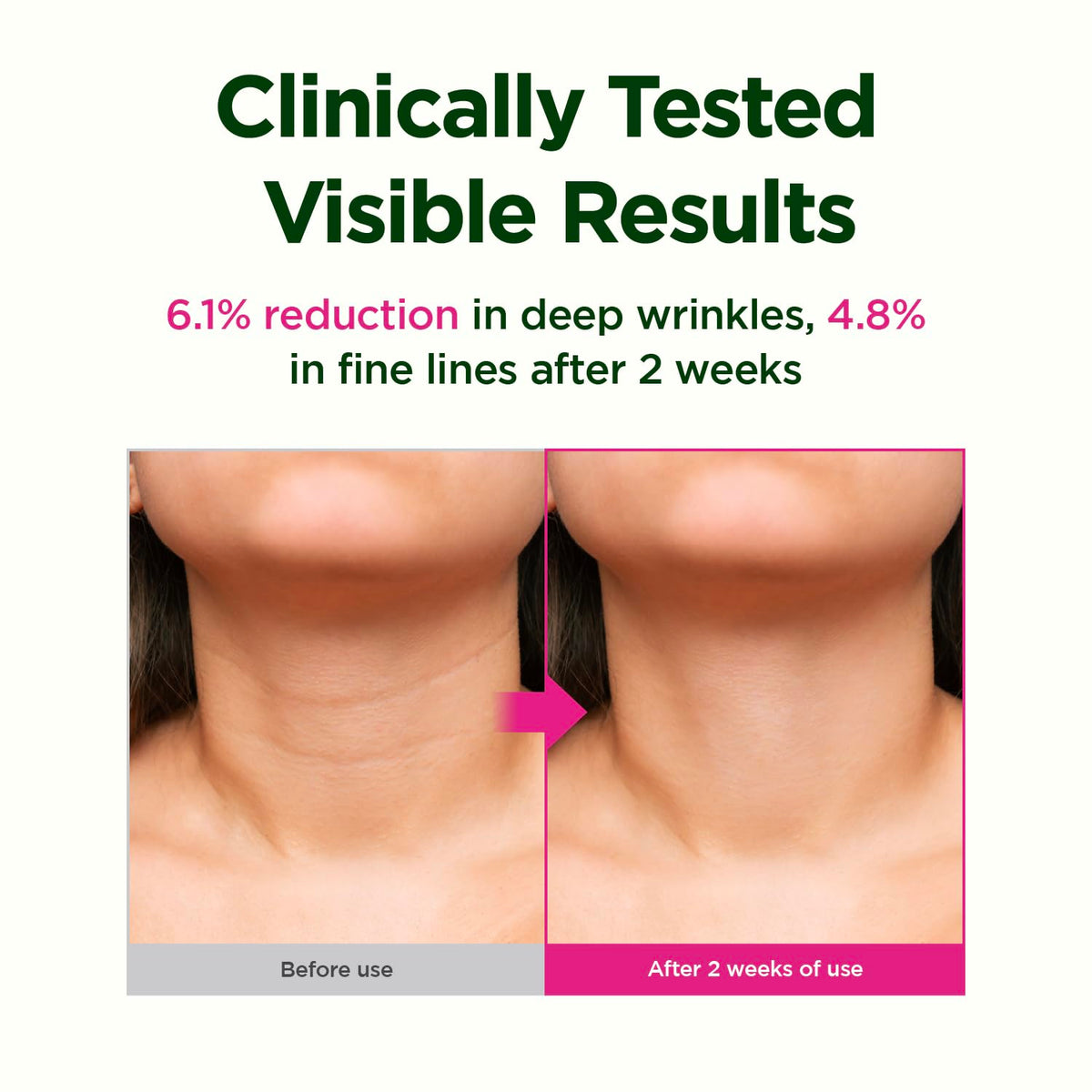 CKD Guaranteed model using gua sha on neck to refresh and reduce puffiness