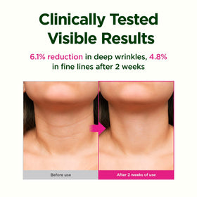 CKD Guaranteed model using gua sha on neck to refresh and reduce puffiness