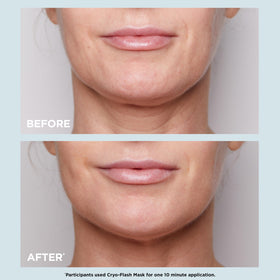 CLARINS before and after images showing visible tightened pores