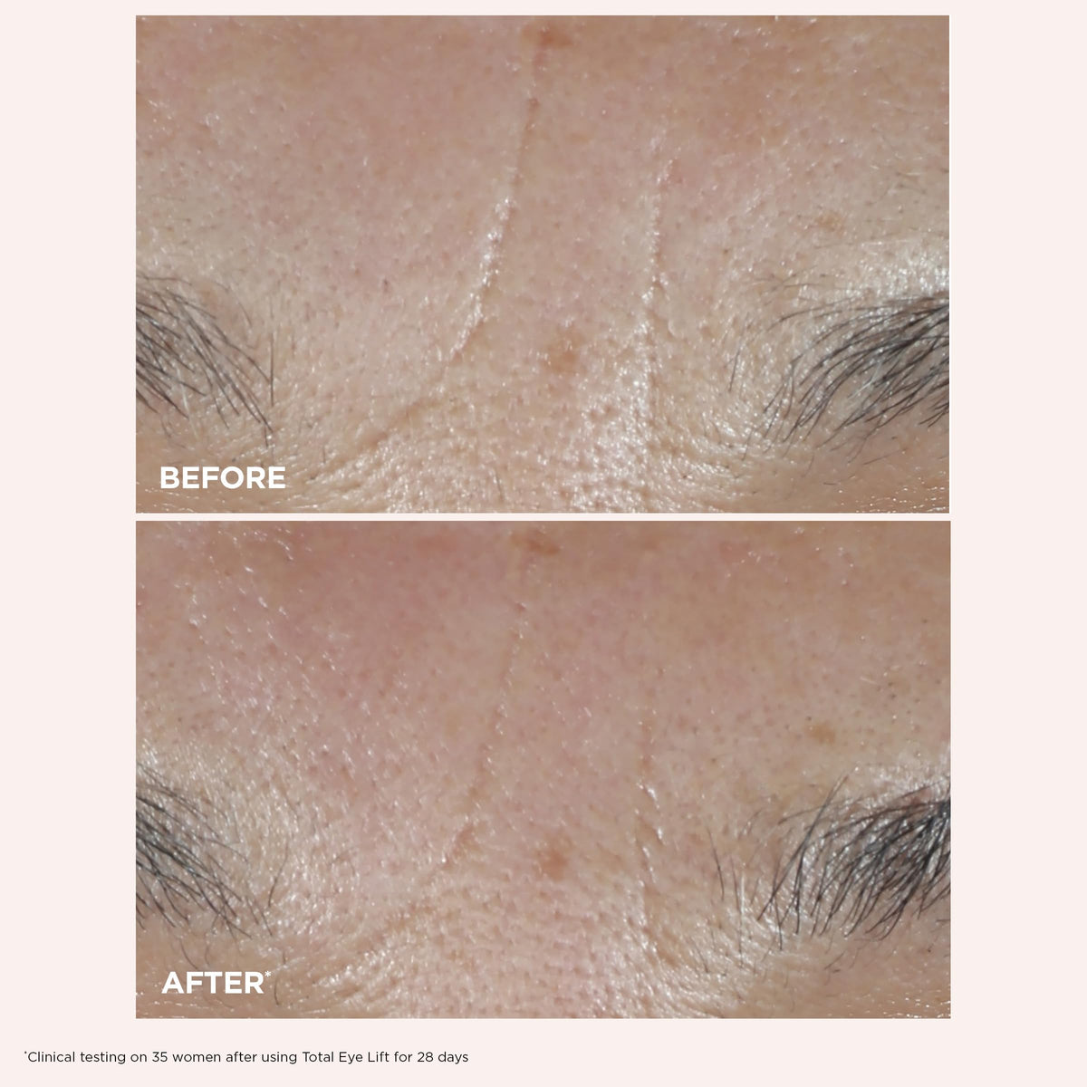 clarins total eye lift application with fingertips for precise targeted lift