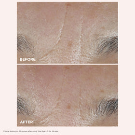 clarins total eye lift application with fingertips for precise targeted lift