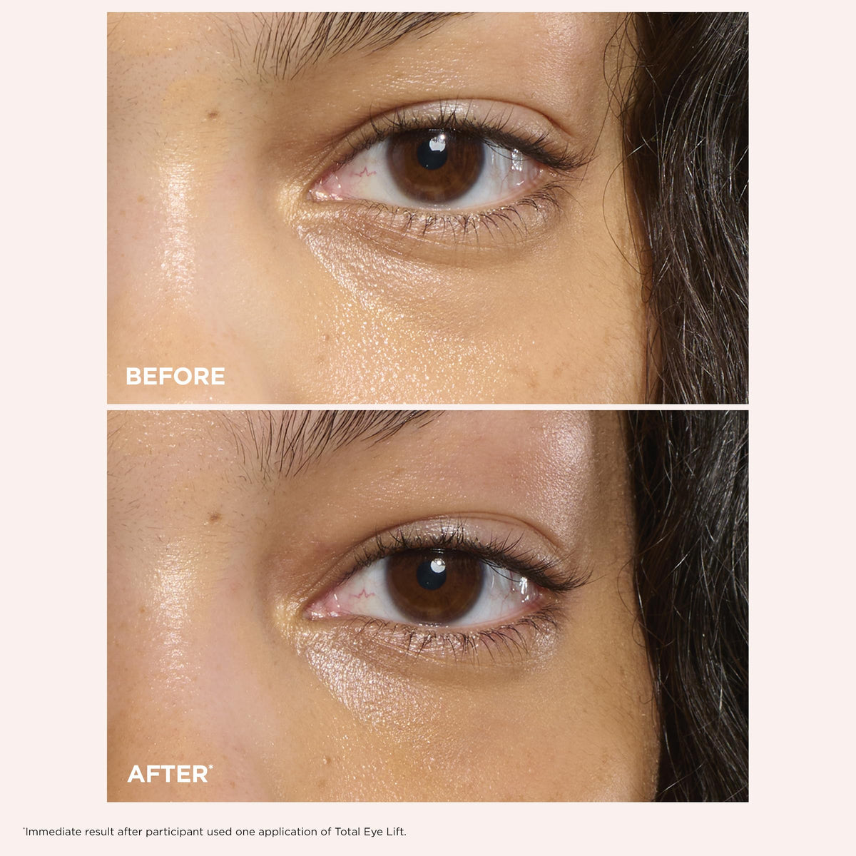 clarins total eye lift before and after photos showing visible smoothing effect