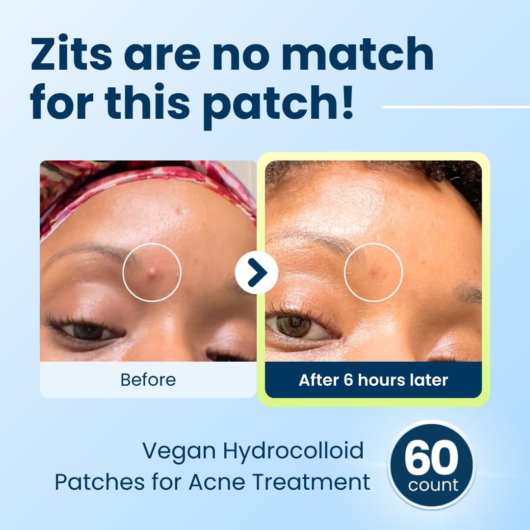 CLEAN SKIN CLUB patch applied to cheek demonstrating discreet protection and reduced visibility