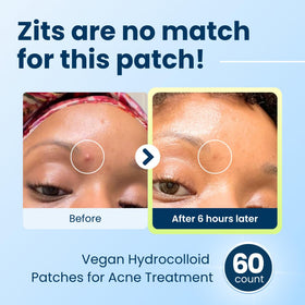 CLEAN SKIN CLUB patch applied to cheek demonstrating discreet protection and reduced visibility