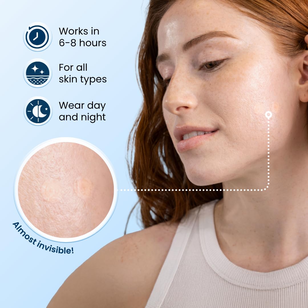 CLEAN SKIN CLUB close-up of an individual hydrocolloid patch texture highlighting gentle adhesion