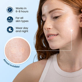 CLEAN SKIN CLUB close-up of an individual hydrocolloid patch texture highlighting gentle adhesion