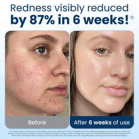 Clean Skin Club XL towel spread flat showing full-face coverage benefit